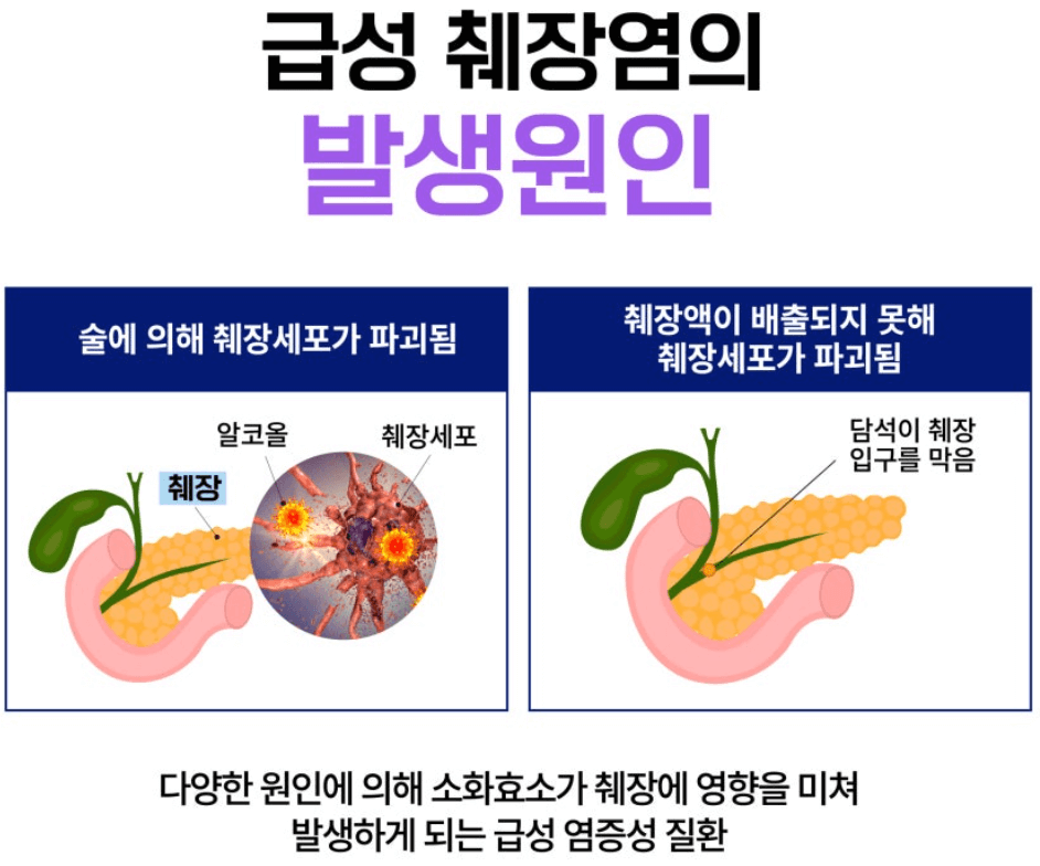췌장염 발생 원인: 몸속에서 벌어지는 염증의 시작