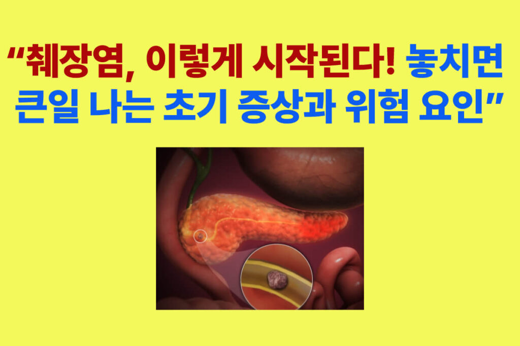 췌장염 초기 증상과 위험 요인을 알리는 건강 정보 썸네일